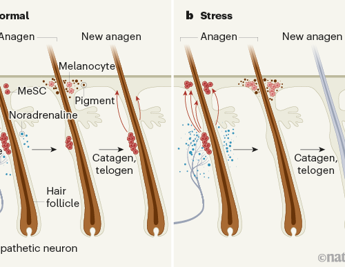 How the stress of fight or flight turns hair white