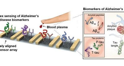 Blood-based multiplexed diagnostic sensor helps to accurately detect