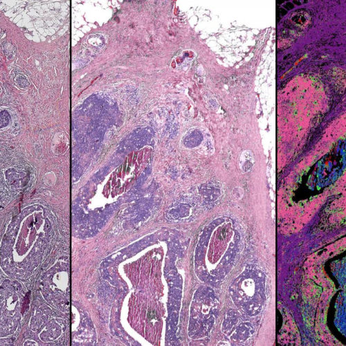 Hybrid microscope could bring digital biopsy to the clinic