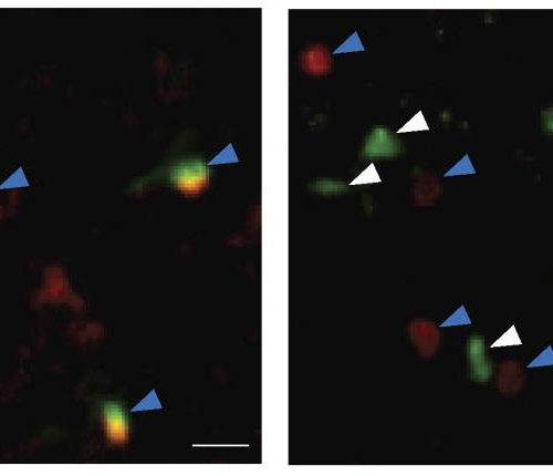 Activating immune cells could revitalize the aging brain, study suggests