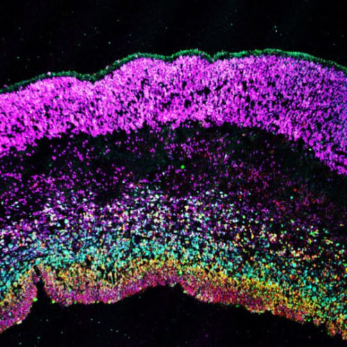 Not ‘Brains in a Dish’: Cerebral Organoids Flunk Comparison to Developing Nervous System