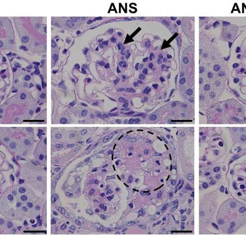 Histamine: an unexpected defender against heart and kidney damage