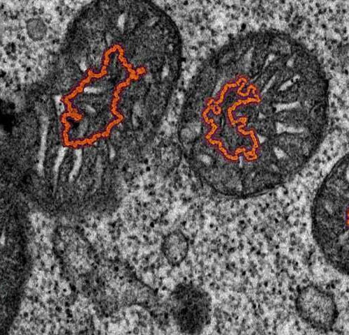 Programming the electron biocomputer with Dopamine redox shuttles