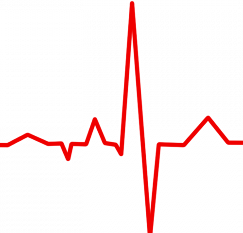 Normal resting heart rate appears to vary widely from person to person