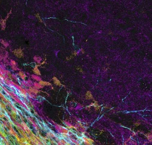 Hard times are coming: Brain tissue stiffness is crucial for neurogenesis
