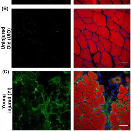 Physiological Roles of Klotho