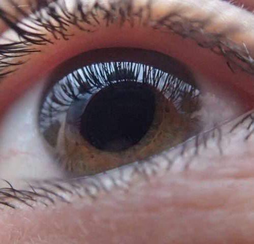 Research team delivers breakthrough for leading cause of blindness