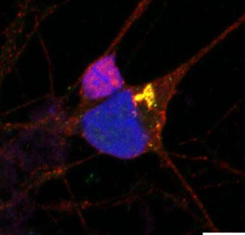 Initial protective role of nervous system’s ‘star-shaped cells’ in sporadic motor neuron disease uncovered