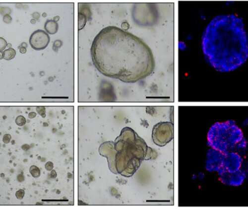 Cancer cell reversion may offer a new approach to colorectal cancer treatment