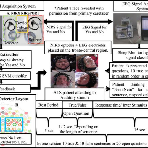 ALS Patients Communicate for First Time in Years With New Device