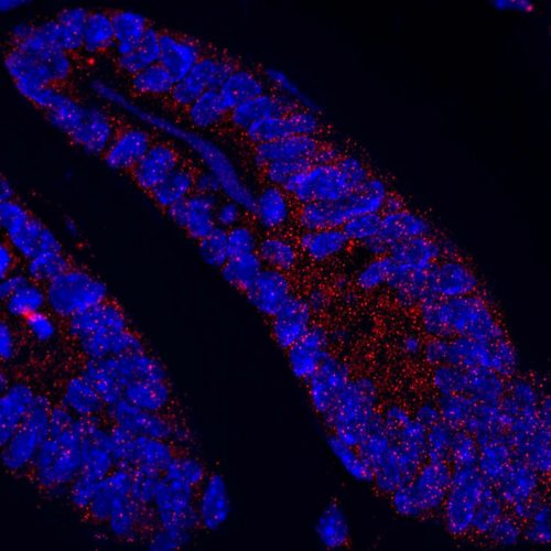 Loss of protein disturbs intestinal homeostasis and can drive cancer