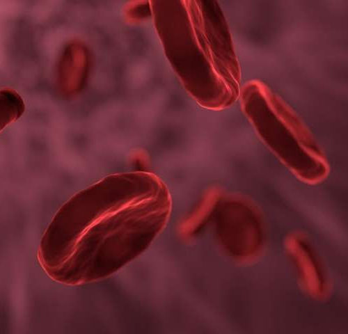 Sickle cell anemia is an inherited form of anemia