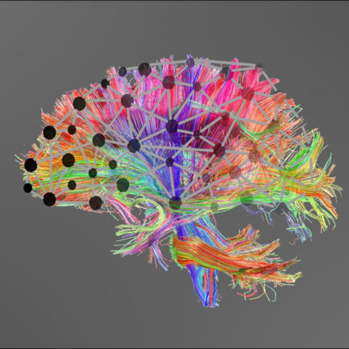 Learning difficulties due to poor connectivity, not specific brain regions