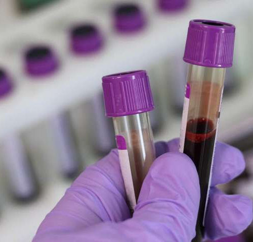 Simple blood test could help reduce heart disease deaths