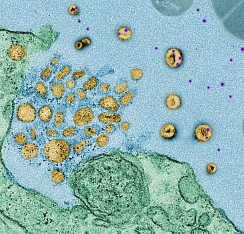 Newfound cell defense system features toxin-isolating ‘sponges’