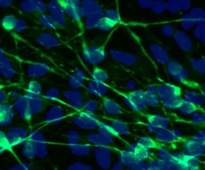 Altered potassium levels in neurons may cause mood swings in bipolar disorder