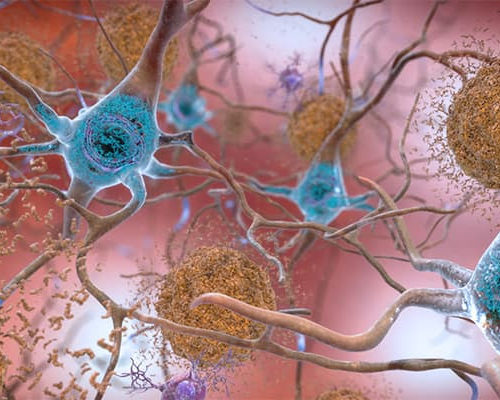 Scientists design new model to further understand causes of Alzheimer’s disease