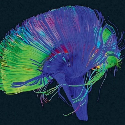 Brain-doping produced by your own body