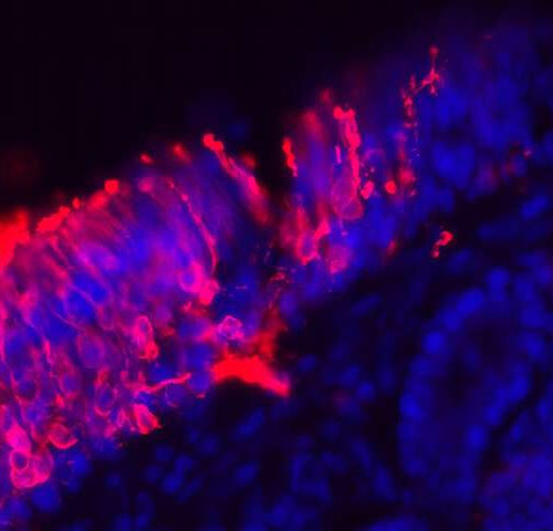 Thriving neuron ‘nursery’ found in a section of adult human nose tissue