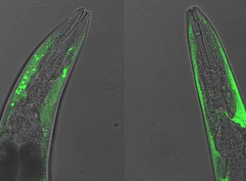 Scientists identify new target for Parkinson’s therapies