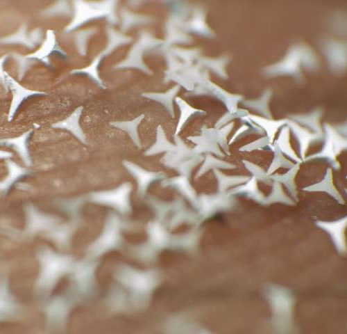 Microscopic STAR particles offer new potential treatment for skin diseases