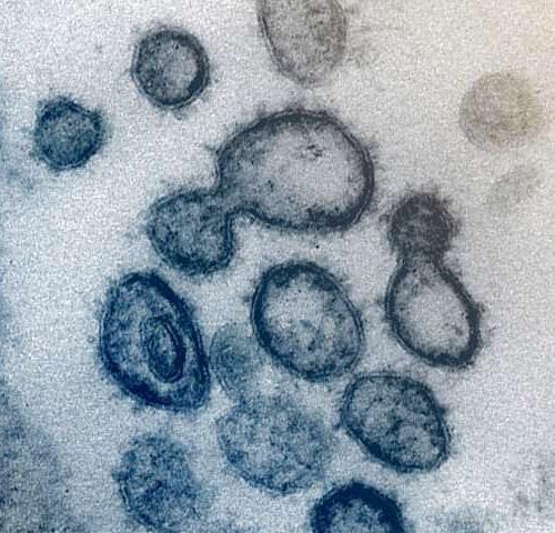 Coronavirus: Can S. Korea be a model for virus-hit countries?