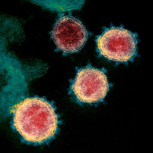 Why does the coronavirus spread so easily between people?