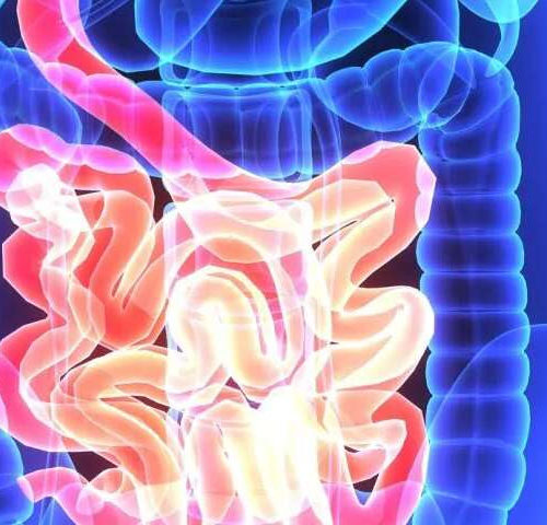 5 ways to fight colon cancers