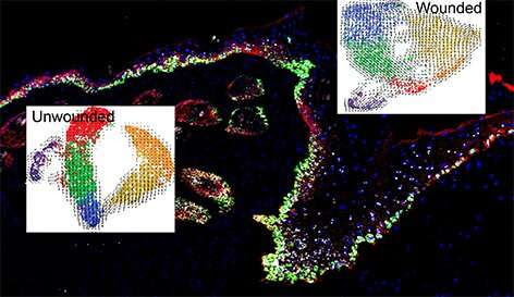 New study reveals how skin cells prepare to heal wounds