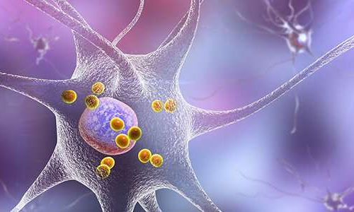 New research gives further evidence that autoimmunity plays a role in Parkinson’s disease