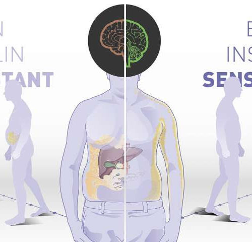 Brain insulin sensitivity determines body weight and fat distribution