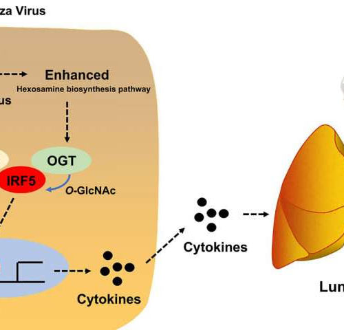 High glucose levels may explain why some flu patients have more severe symptoms