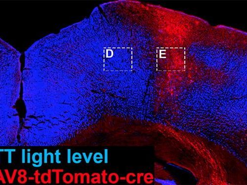 When damaged, the adult brain repairs itself by going back to the beginning