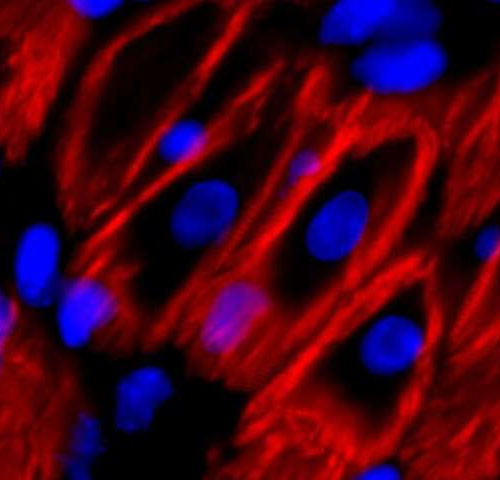 Heart cells can rejuvenate and multiply to heal damage