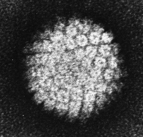 Scientists find new way to block cancer-causing HPV virus