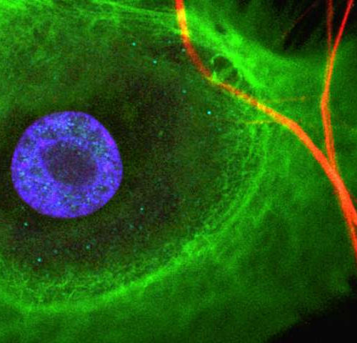 Stem cells and nerves interact in tissue regeneration and cancer progression