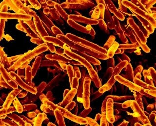 Stanford-led study shows kids exposed to TB at higher risk of disease than thought