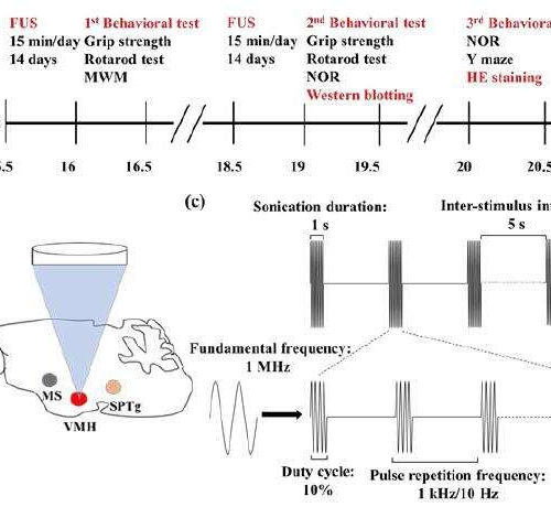 Transcranial ultrasound stimulation can modulate hypothalamus: study