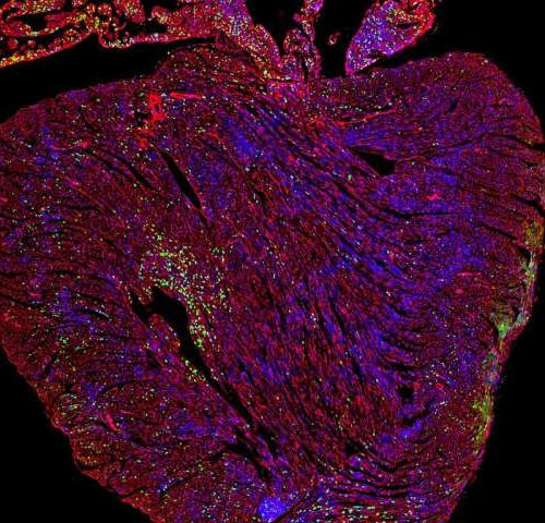 Switching on a key cancer gene could provide first curative treatment for heart disease