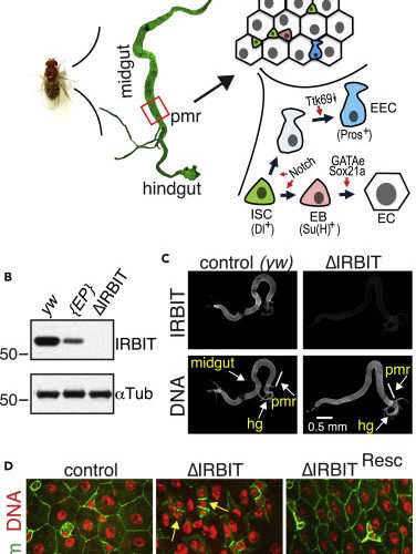 IRBIT Directs Differentiation of Intestinal Stem Cell Progeny to Maintain Tissue Homeostasis