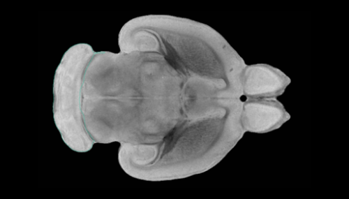 Researchers successfully repair stroke-damaged rat brains