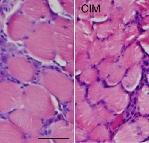 Cells must age for muscles to regenerate in muscle-degenerating diseases