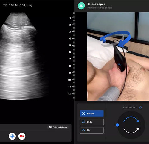 Butterfly TeleGuidance for Remote Ultrasound Exams During COVID Pandemic