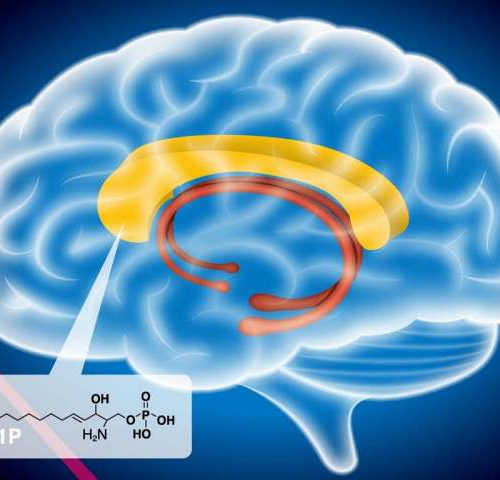Schizophrenia related to abnormal fatty metabolism in the brain
