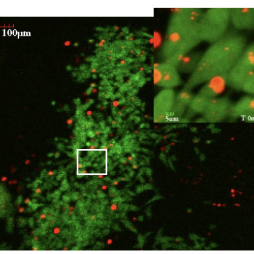 NANOPARTICLES ENTER LIVING CELLS TO GATHER CANCER CLUES