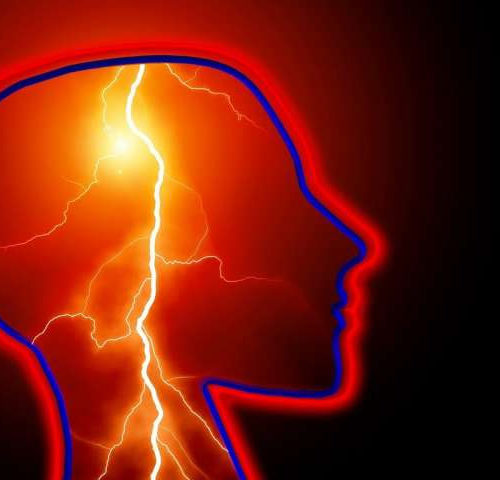 What women should know about stroke