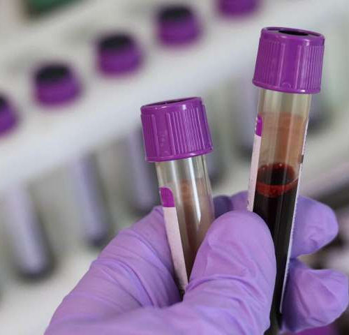 Blood test helped detect cancer before symptoms, study finds