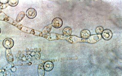 New drug formulation could treat Candida infections