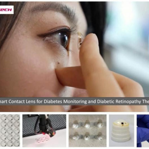 Smart contact lenses that diagnose and treat diabetes