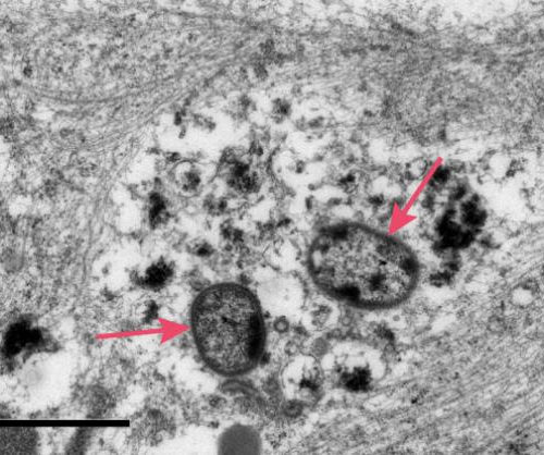 Cortexyme publishes data on P. gingivalis ability to infect neurons